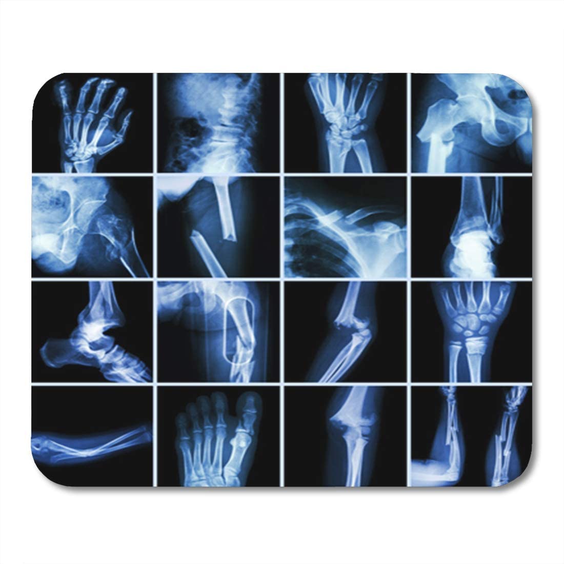 Roentgen Mobile X Ray at home Hyderabad & Bangalore 9949754080